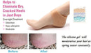 Axooms Silicone Gel Heel Pad Socks – Pain Relief & Heel Support, 1 Pair (Beige, Free Size)