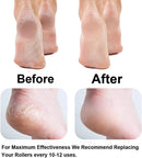 Axooms Rechargeable Pedicure Callus Remover for Dead Skin, Hard and Cracked Skin, Foot Scrubbing Roller