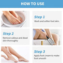 Axooms Stainless Steel Foot File & Callus Remover, Pedicure Foot Scrubbing Tools, 3-Piece Pack, Black