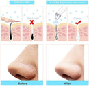 Axooms 4-in-1 Multifunction Blackhead Remover, Acne and Pimple Removal Pore Tool for Men and Women