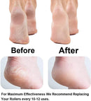 Axooms Electronic Pedicure Tool, Rechargeable Electric Foot Callus Remover & Dead Skin Roller