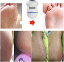 Axooms Rechargeable Electric Callus Remover with Built-In Vacuum, Professional Pedicure Tool for Dry, Hard and Dead Skin