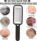 Axooms Stainless Steel Foot File & Callus Remover, Pedicure Foot Scrubbing Tools, 3-Piece Pack, Black